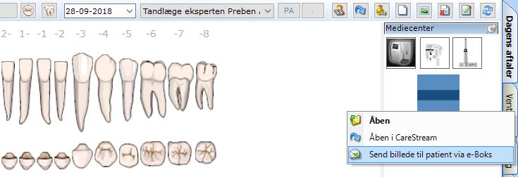 send røntgenbillede til e-boks